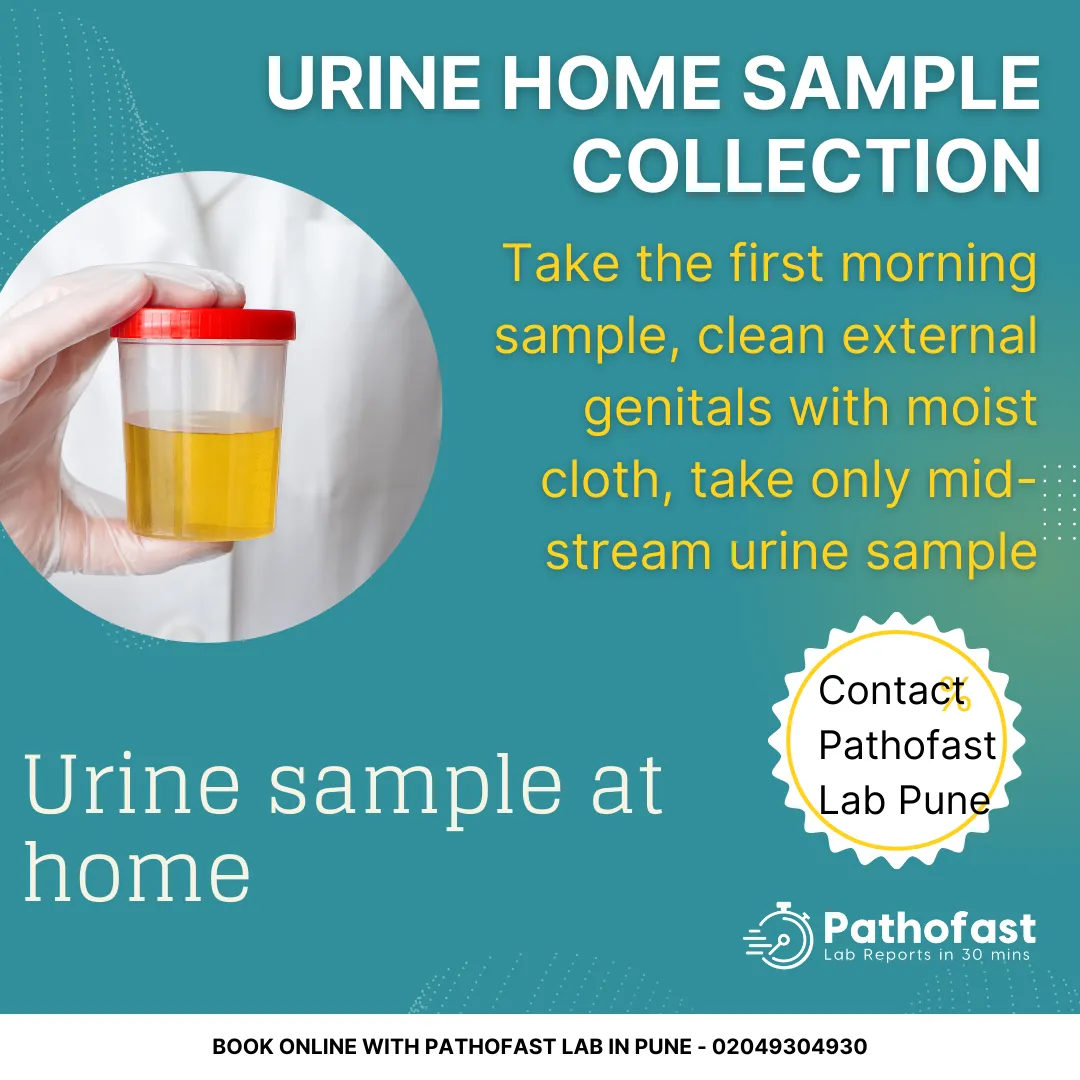 Home Urine Sample Collection Guidelines in Pune