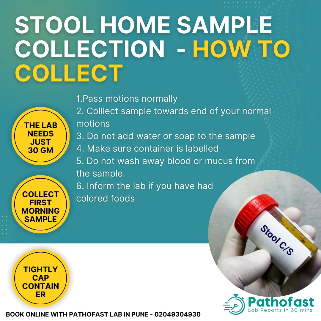 Stool Sample Collection Guidelines at Home in Pune