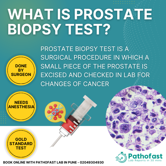 5 Best Tests For Prostate Cancer Screening And Diagnosis