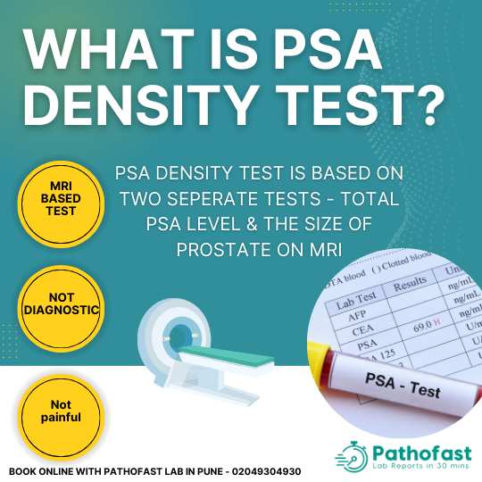 Prostate Density Test