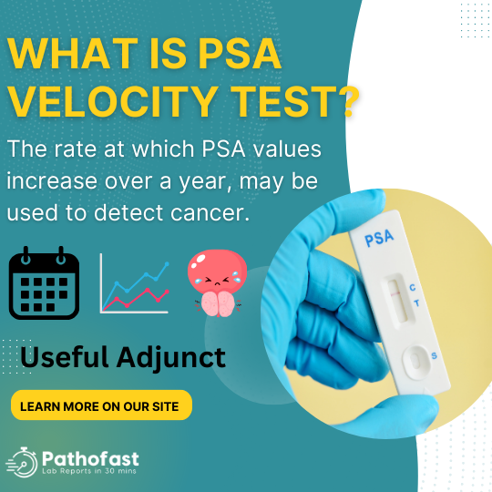 What is prostate velocity and prostate doubling time test?