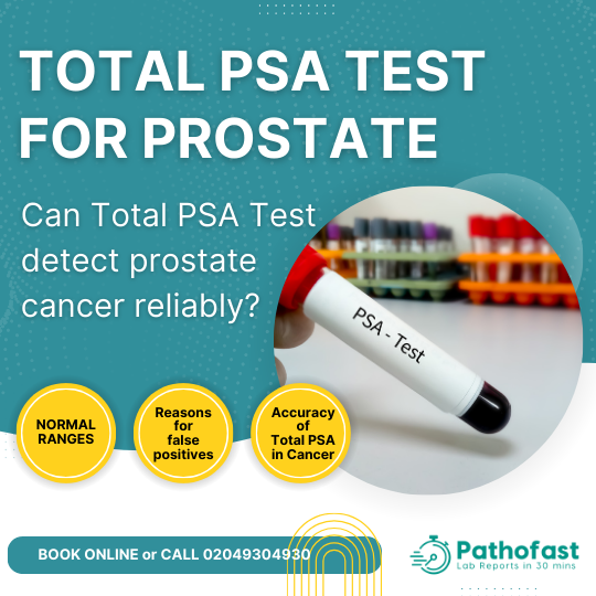 Total Prostate Specific Antigen or PSA Level