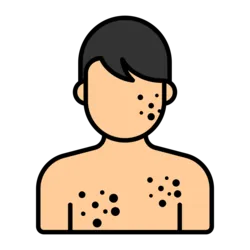 List of Tests for Skin rash or hives