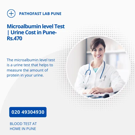 Microalbumin level Test | Urine Cost in Pune