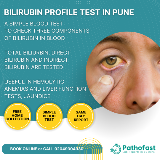 Bilirubin Profile Test in Pune - Bilirubin Total, Direct and Indirect Test in Pune