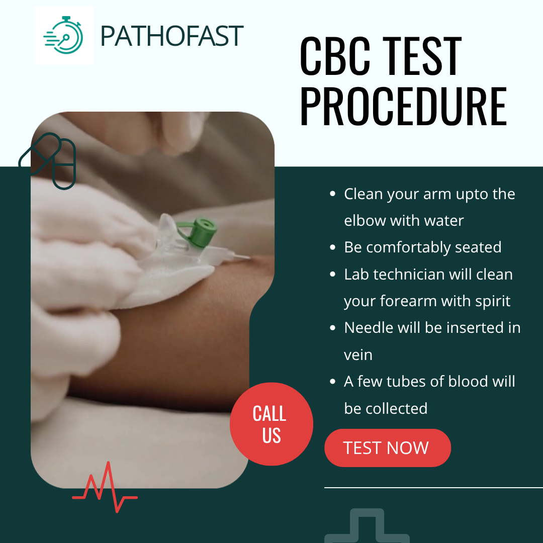 CBC Test - Procedure of Hemogram/CBC Test