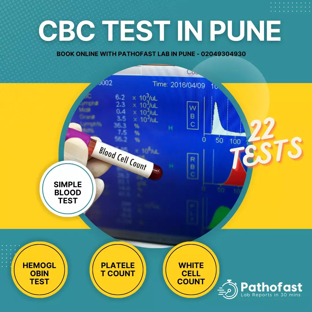 CBC Test in Pune
