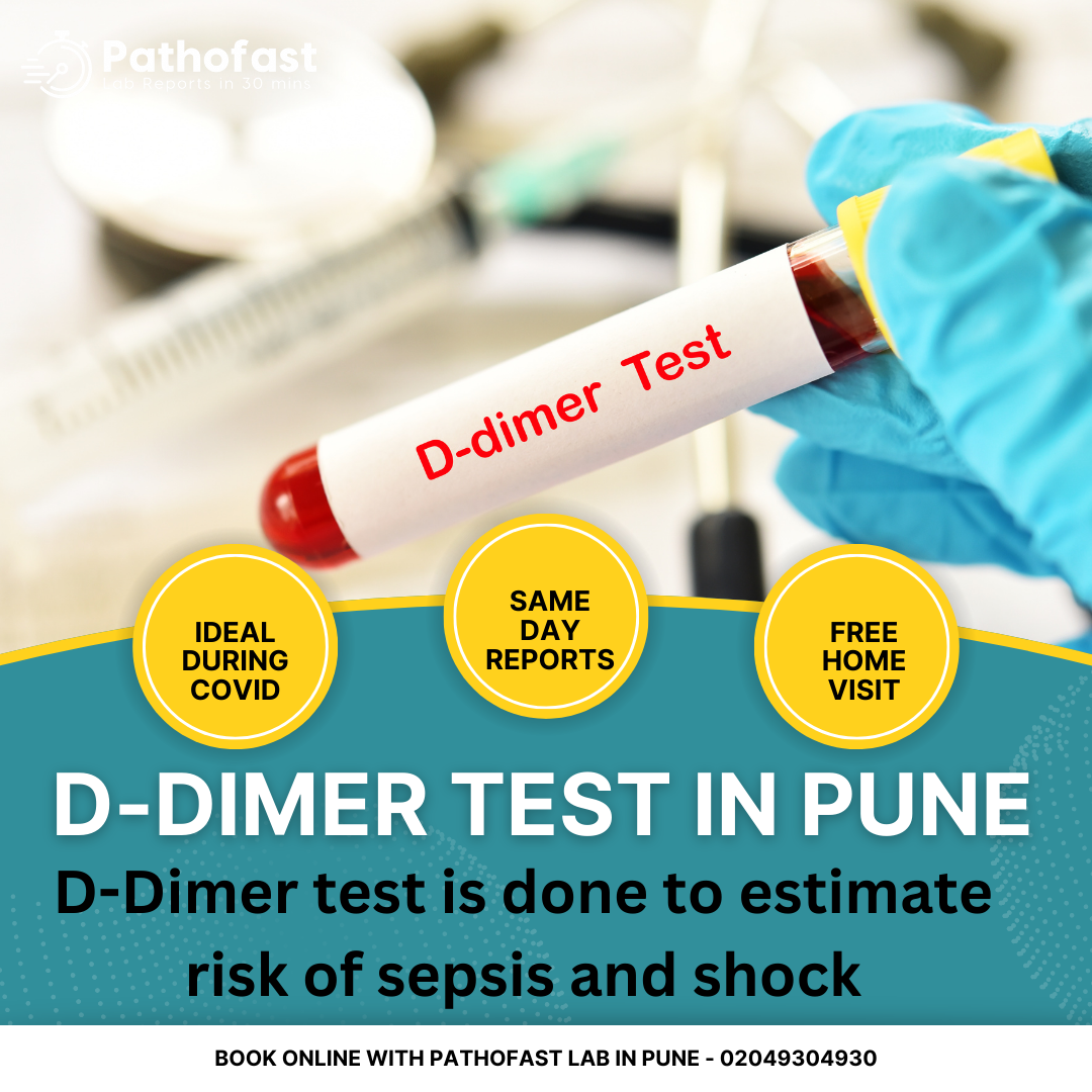 D-Dimer Test in Pune for sepsis and shock