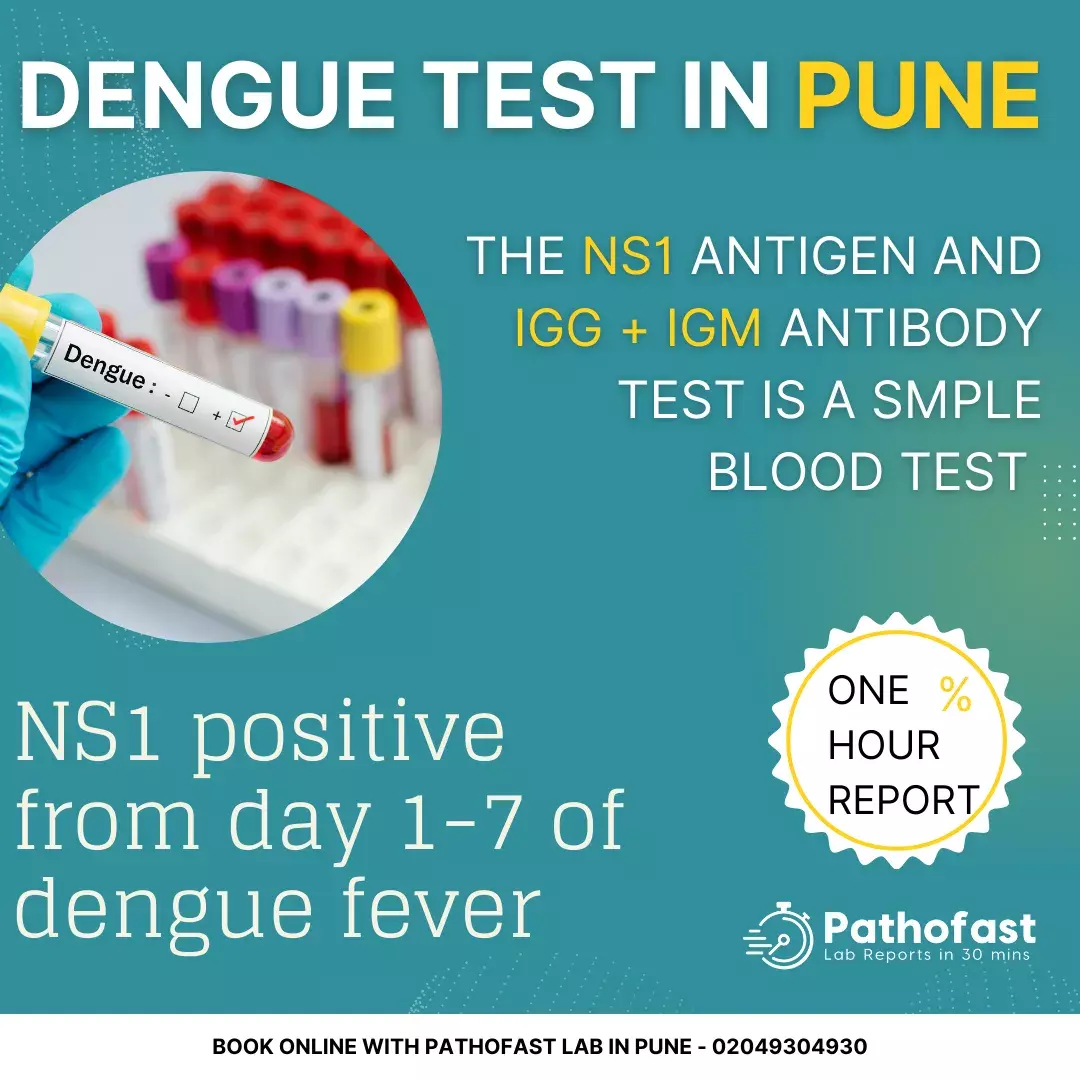 Dengue Test in Pune