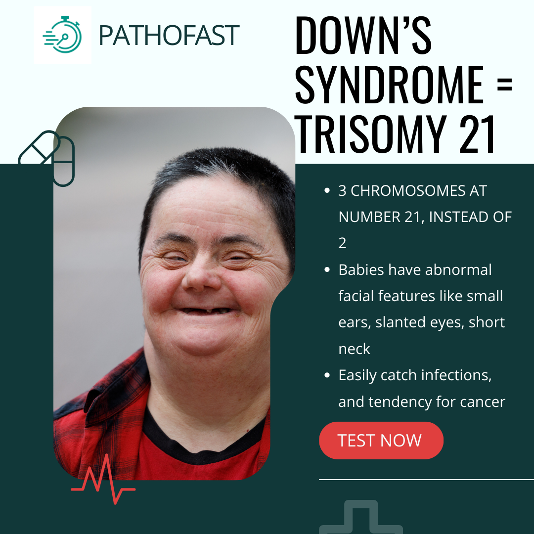 Down's Syndrome