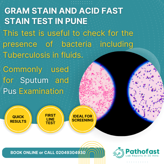 Gram Stain and Acid Fast Stain or Ziehl Nielson Test in Pune for bacterial screening and diagnosis including Tuberculosis Screening in Sputum