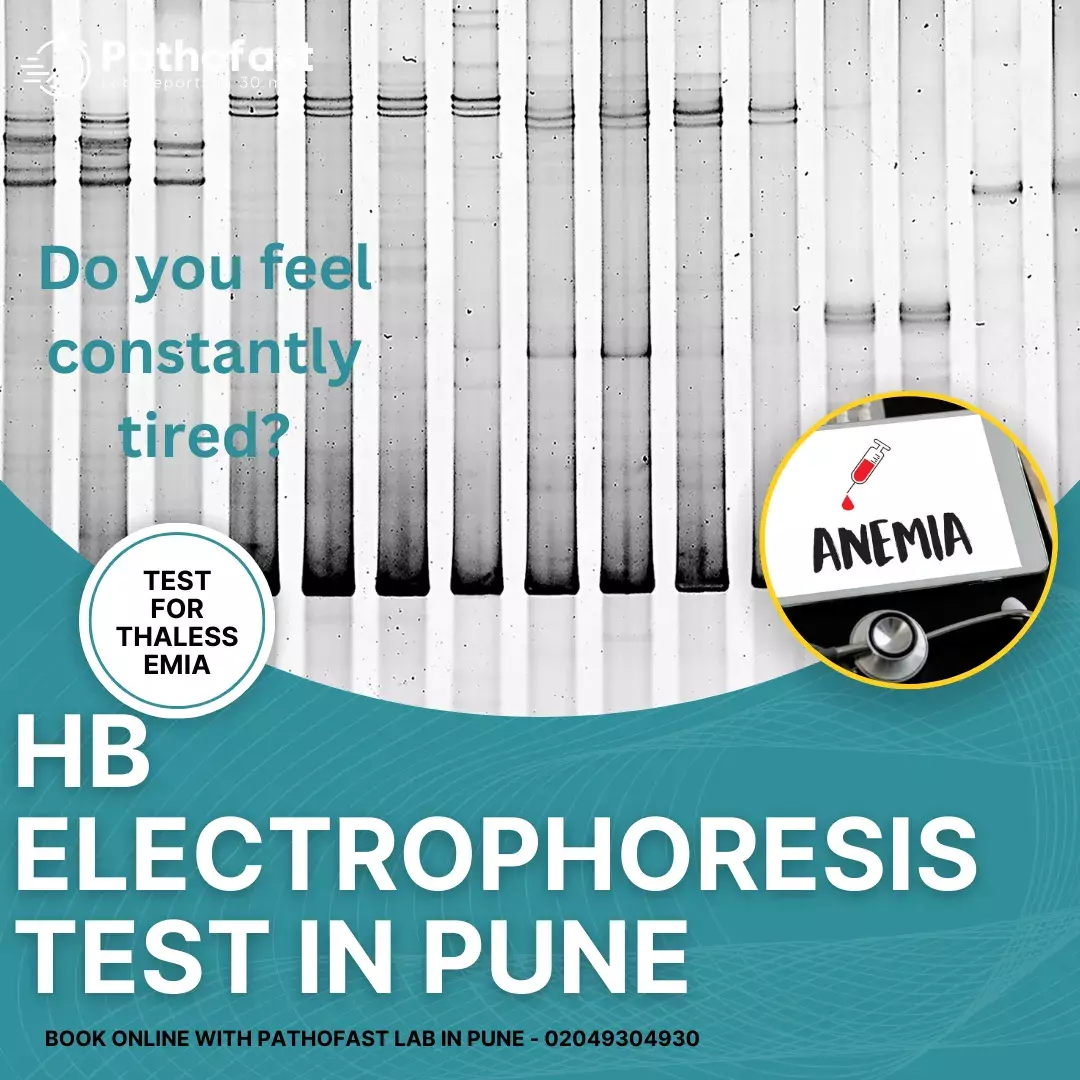 HB Electrophoresis Test in Pune