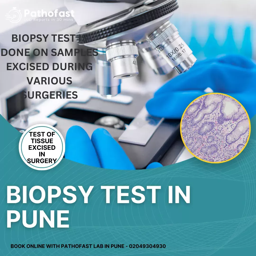 Biopsy Test in Pune - Histopathology Test in Pune