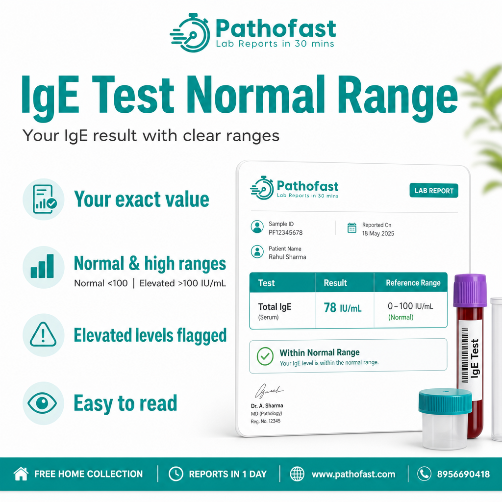 What is included in a IgE Test report - Pathofast Lab Pune