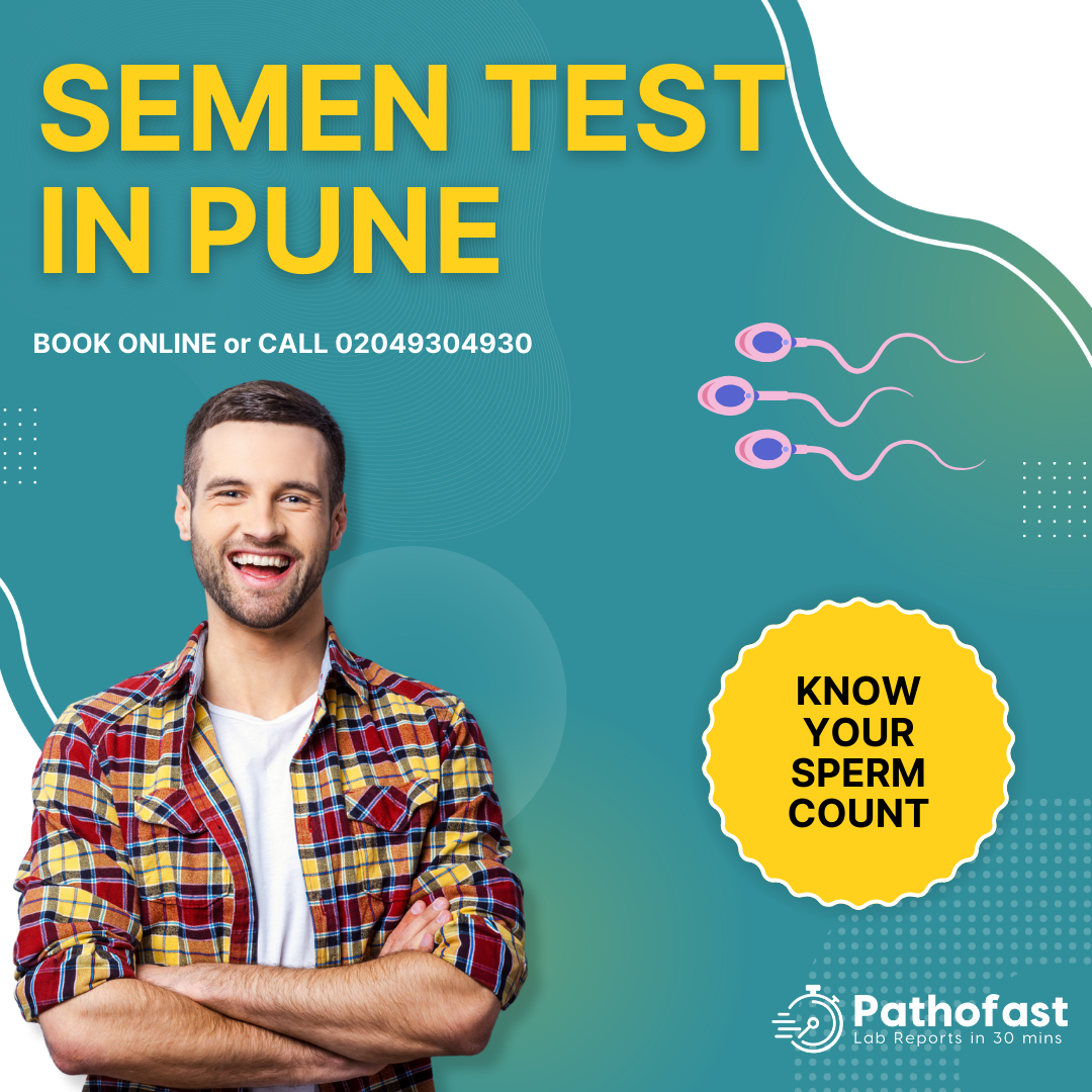 Semen Test in Pune - Sperm Count Test in Pune
