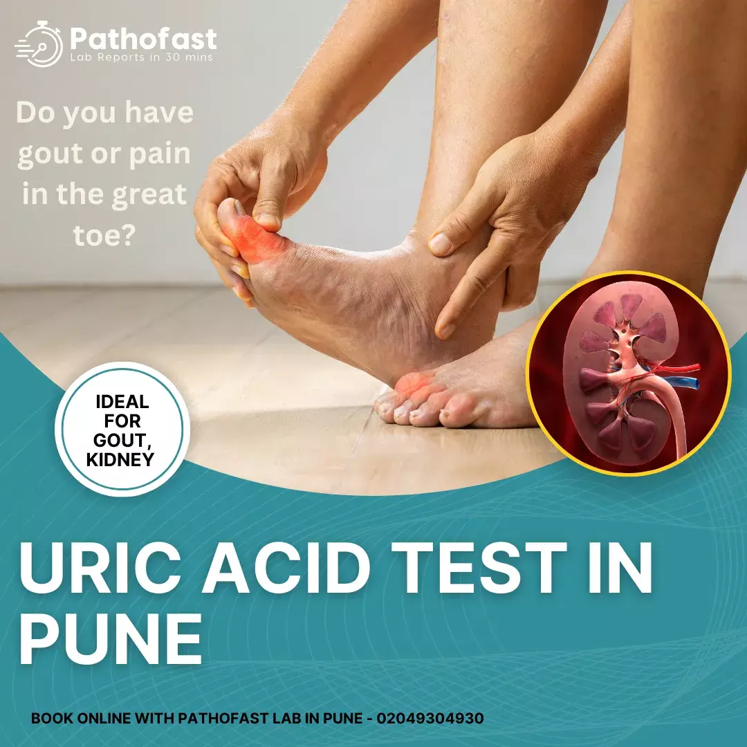 Uric Acid Test in Pune - Test for Gout