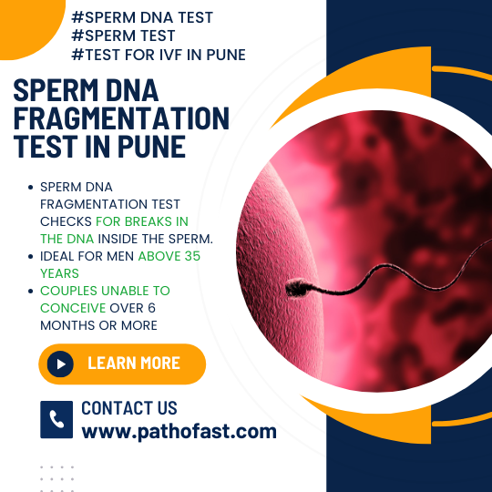 Sperm DNA Fragmentation Test in Pune