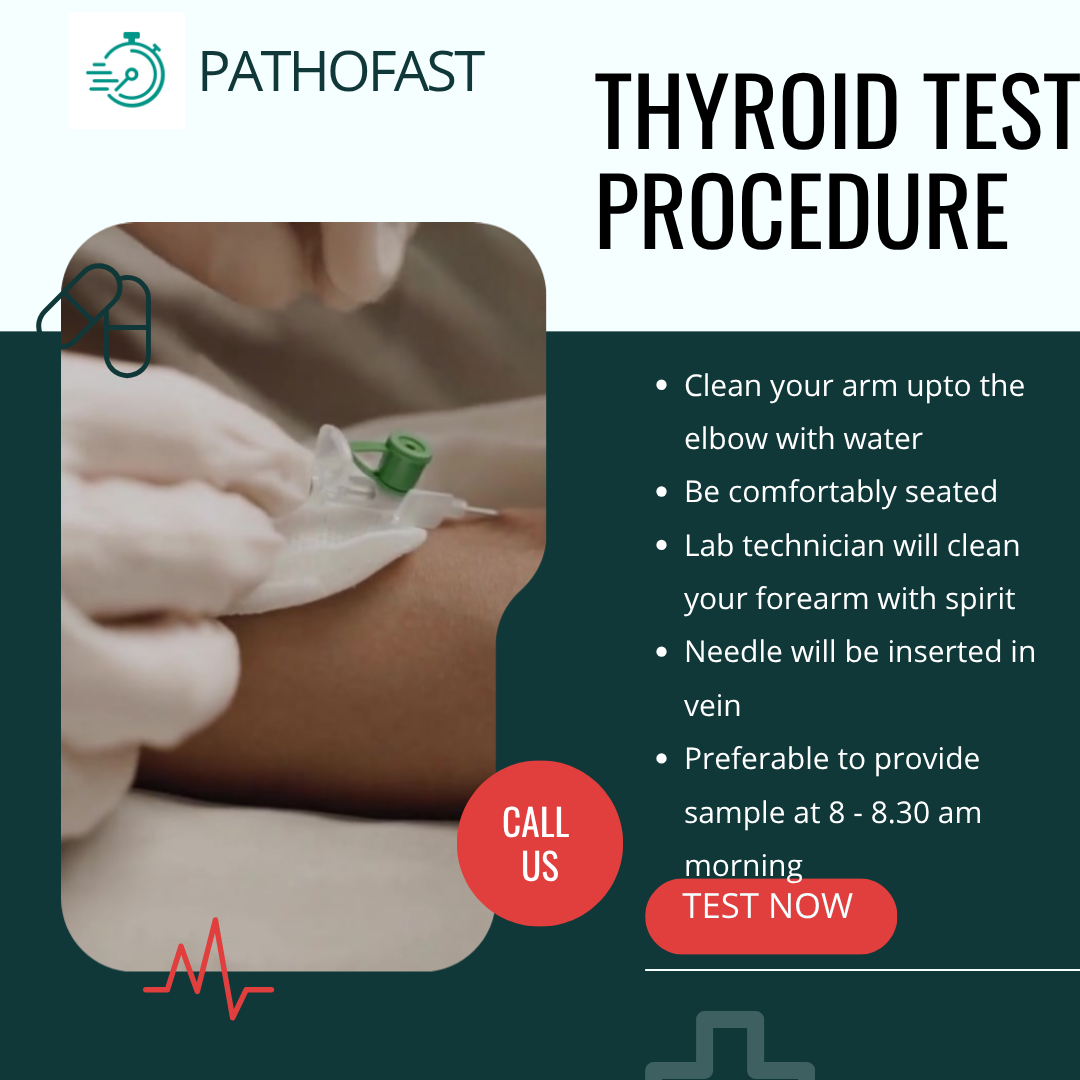 Thyroid Blood Test Procedure - and preparation