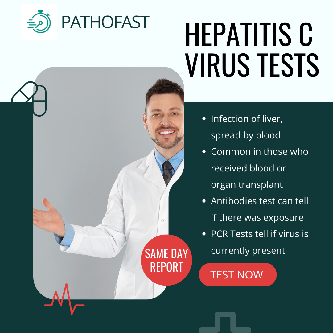 About HCV Test (Total HCV Antibodies)
