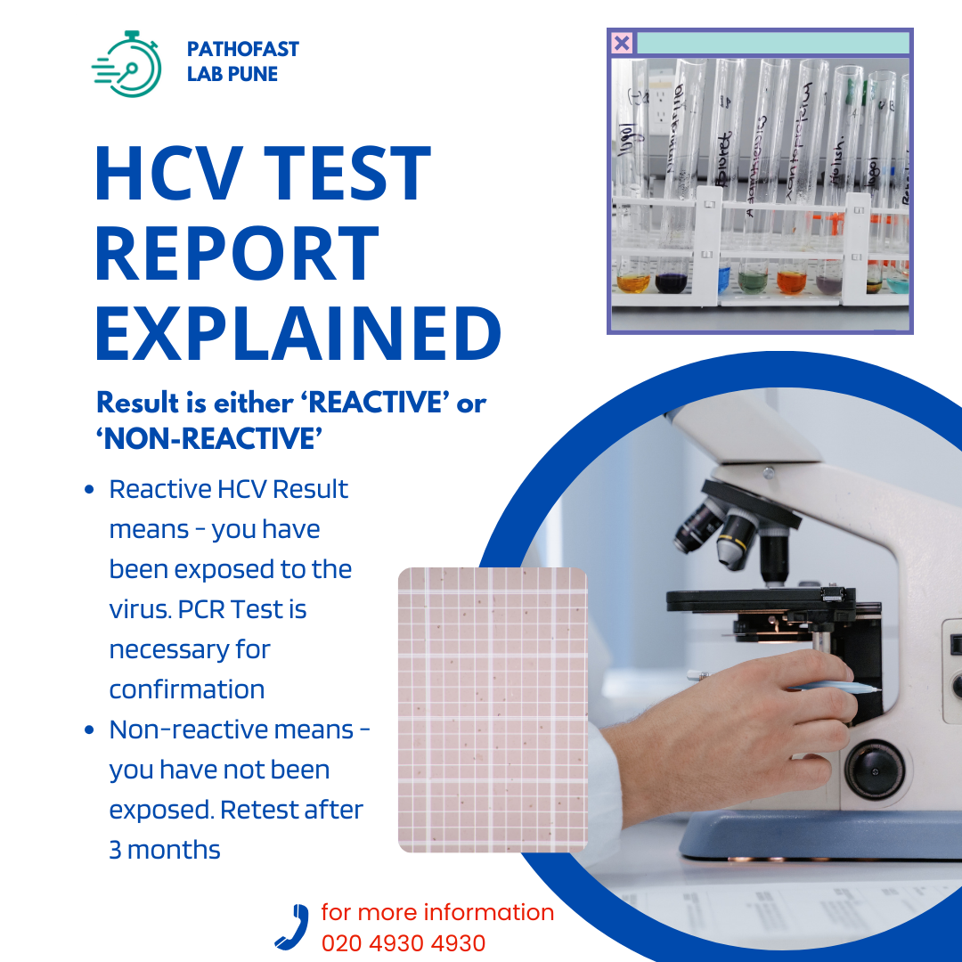 Understanding HCV Test (Total HCV Antibodies) report