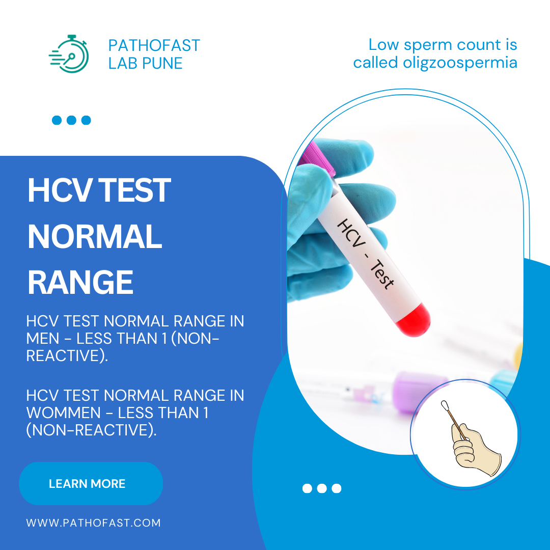 HCV Test (Total HCV Antibodies) Normal Range