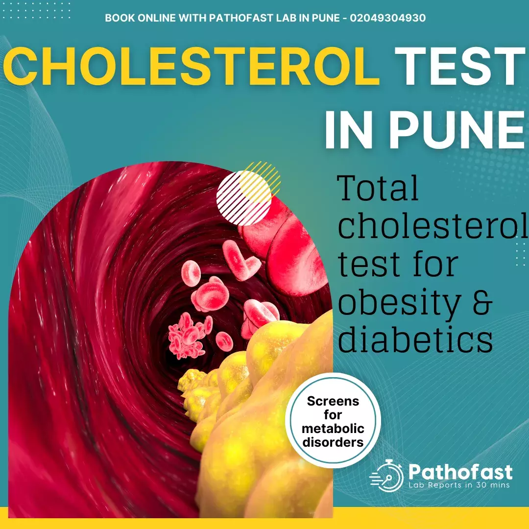 Cholesterol Test in Pune 