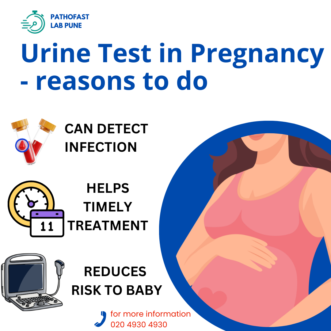 Advantages of Urine Test in Pregnancy
