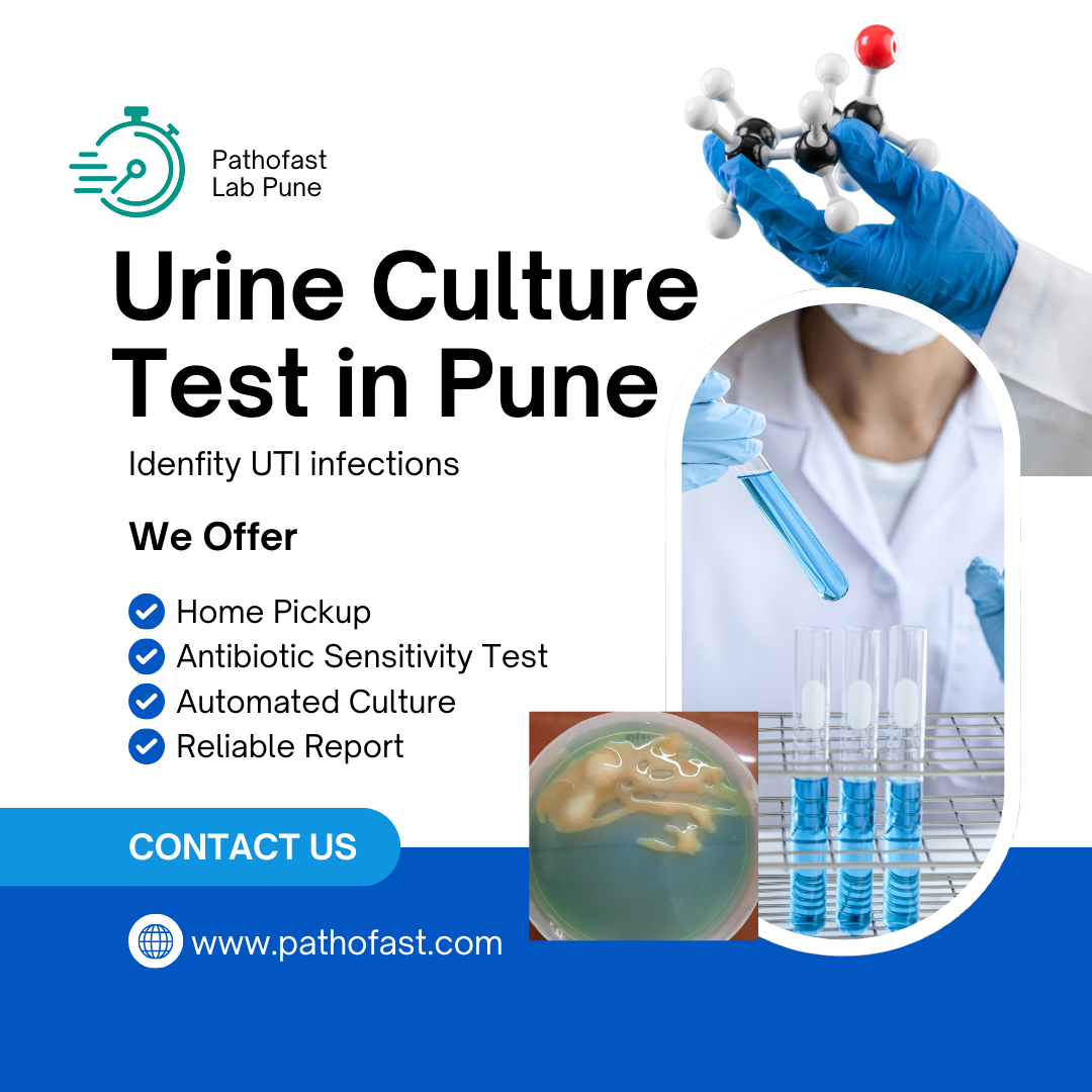 Urine Culture Test in Pune | Urine C/S : Book Now