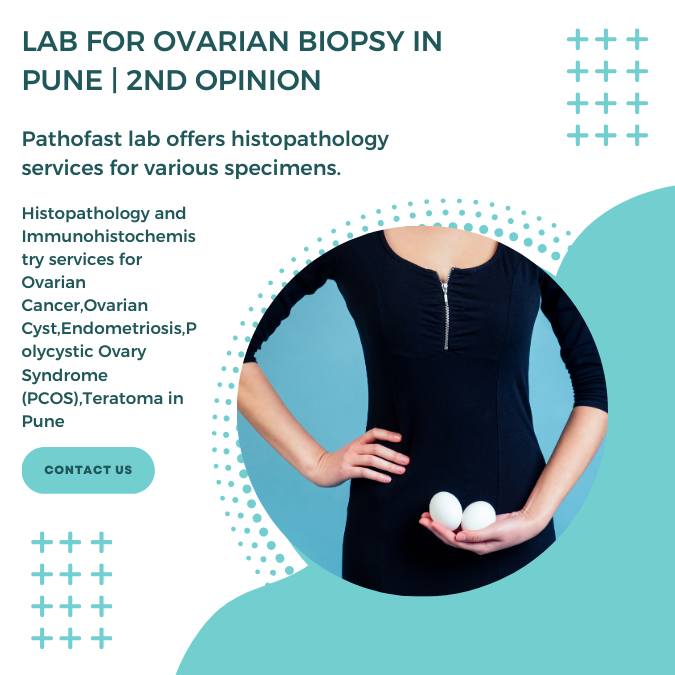 Lab for ovary biopsy in Pune | 2nd Opinion for ovarian cancer